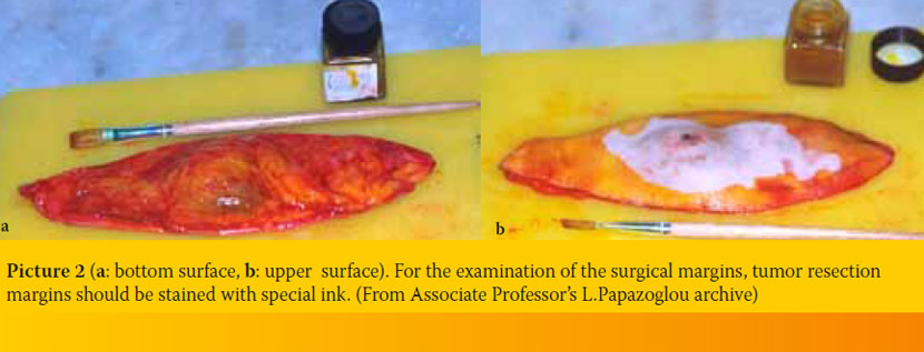 Τissue handling by the practitioner; from collection to submission of the sample to the histopathology lab