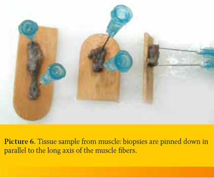 Τissue handling by the practitioner; from collection to submission of the sample to the histopathology lab