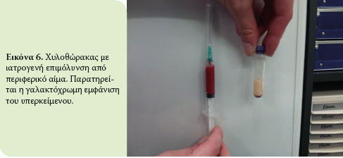 Υπεζωκοτικές συλλογές της γάτας: εστιάζοντας στην εργαστηριακή διάγνωση 