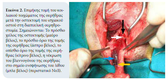 Διαπυελική ουρηθροστομία σε τρεις γάτους