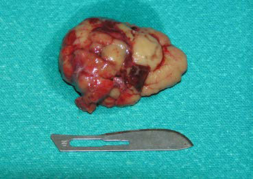 Neoplasia of lacrimal gland origin in a dog