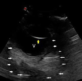 Neoplasia of lacrimal gland origin in a dog