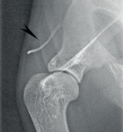 v8i2 differences orthopaedics img2