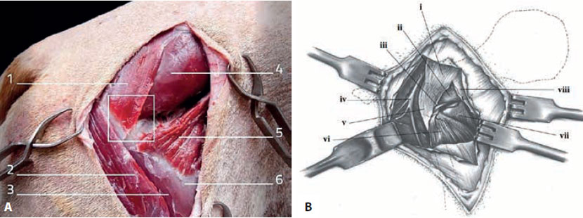 v8i2 femoral head excision img5