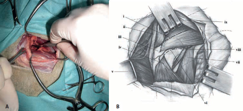 v8i2 femoral head excision img8