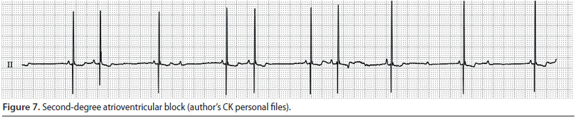 v8i2 perioperative cardiac arrhythmias img7 en